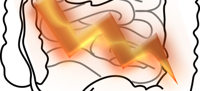 Nuovi Farmaci Per Il Trattamento Della Colite Ulcerosa Ustekinumab Vedolizumab E Adalimumab Newence